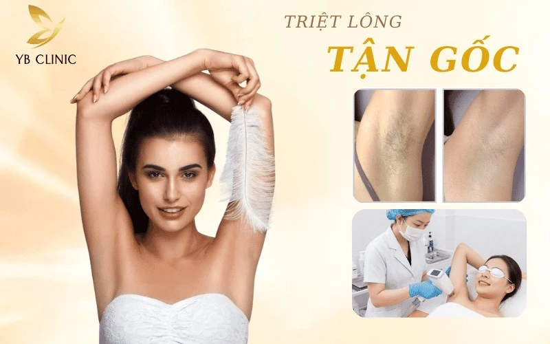 Voucher Triệt Lông Tại Yb Spa Và Những Điều Cần Biết 7 Liệu trình triệt lông nách bằng công nghệ hiện đại giúp da sáng mịn tại YB Spa.