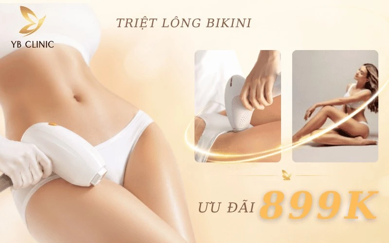Voucher Triệt Lông Tại Yb Spa Và Những Điều Cần Biết 8 Gói triệt lông bikini đi kèm nhiều quà tặng chăm sóc da chuyên sâu hấp dẫn.