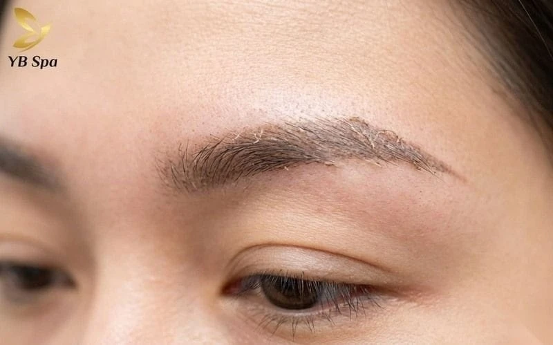 Giai đoạn bong vảy tự nhiên, không nên chạm tay hay cạy để tránh ảnh hưởng màu mực.