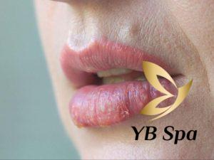 Xăm môi bị nổi mụn nước có sao không? Nguyên nhân do đâu?