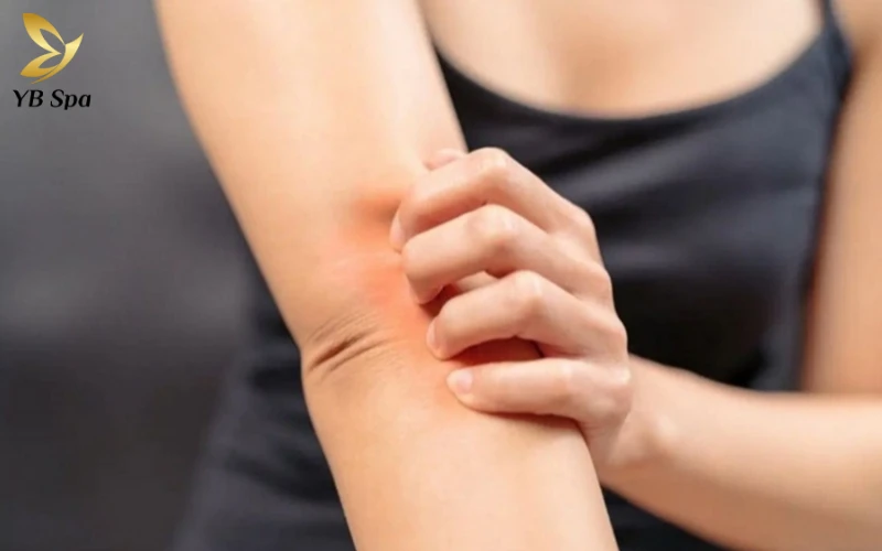 Triệu chứng đặc trưng của Zona