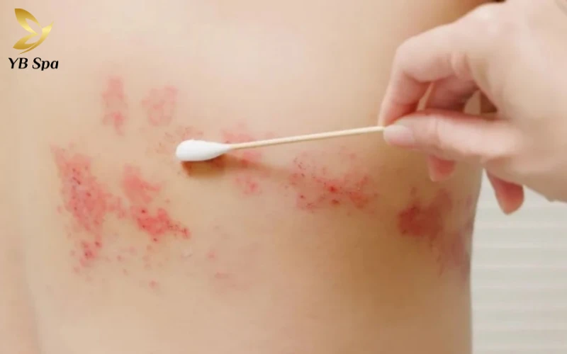 Thuốc kháng virus